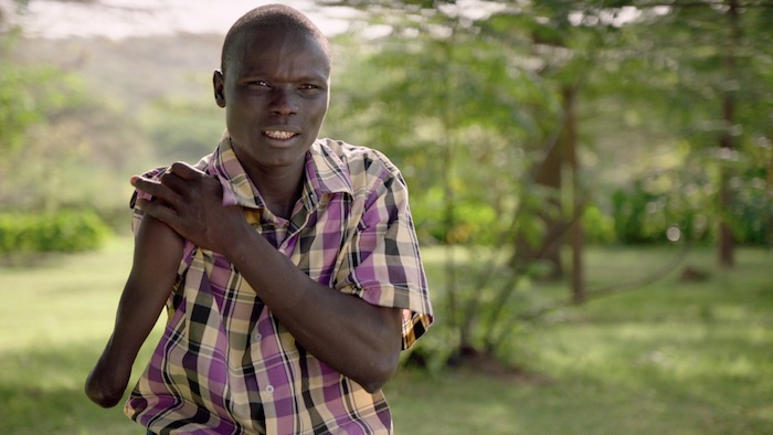 Snakebite victim Sundai, from Kenya's Baringo County. Lillian Lincoln Foundation (www.minutestodie.com)