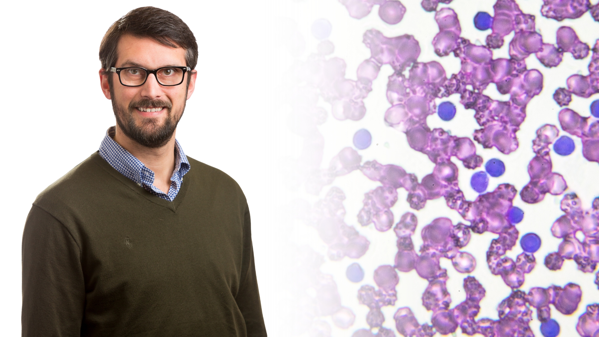 Portrait of Dr Daniel Utzschneider from the Doherty Institute and microscopy image of Chronic Lymphocytic Leukemia (CLL) blood smear