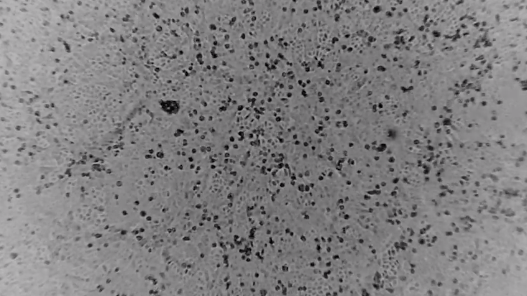Still photography from time lapse video of novel coronavirus 2019-nCoV growing in Vero E6 cells.