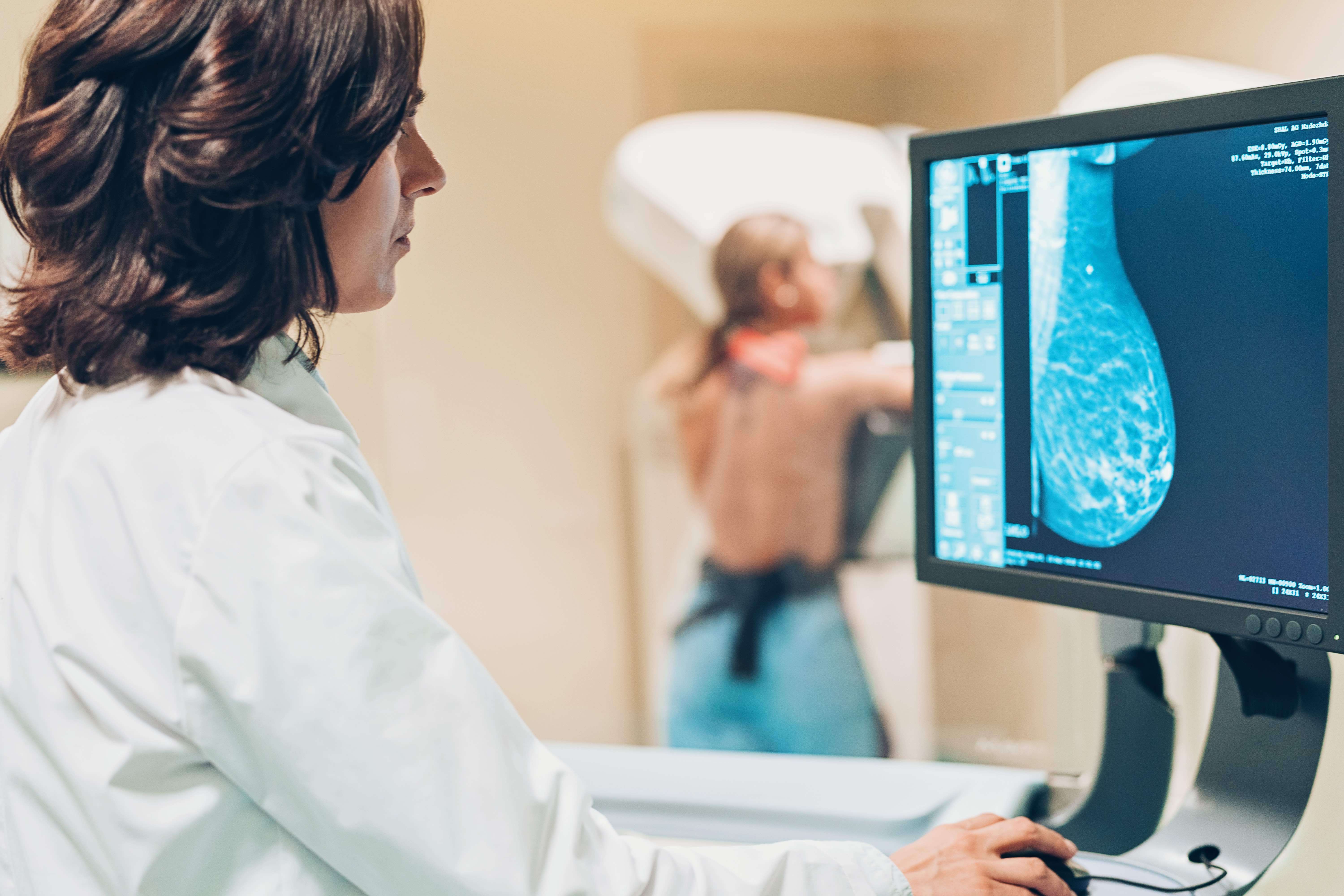 New Mammogram Measures Of Breast Cancer Risk Could Revolutionise Screening 4895